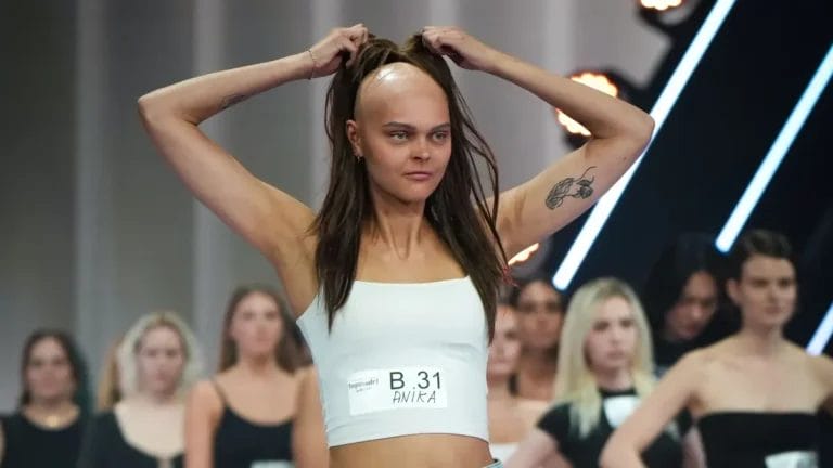 GNTM 2026 Anika im Interview über ihre Krankheit: „Das bin halt jetzt einfach ich und das hab ich akzeptiert“
