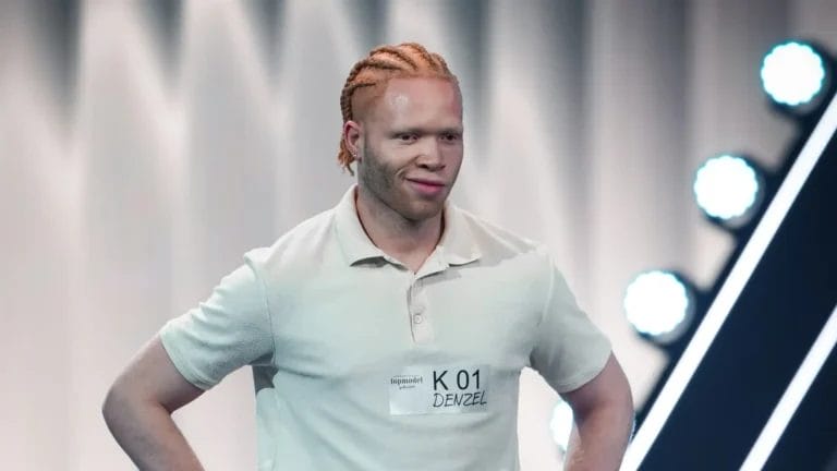 GNTM 2026 Denzel spricht offen über seinen Albinismus: „Wurde früher wegen meines außergewöhnlichen Aussehens oft gemobbt“